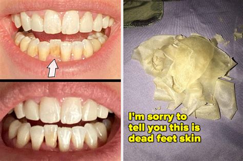 29 Products With Gnarly Before And After Photos